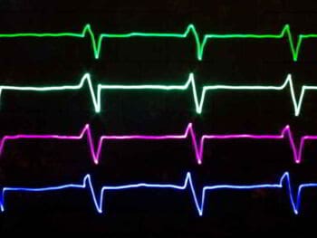 ¿Qué es el ciclo económico?