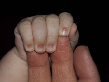 Diferencias y similitudes entre calidad total EFQM e ISO