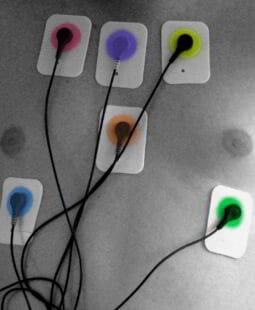 Compromiso energético y esfuerzo cardiovascular de los trabajadores