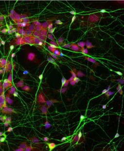 Neuroeconomía y neurociencias